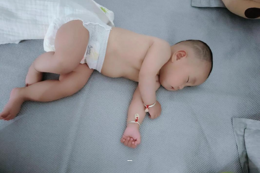 云梦宝宝脸上有白色斑块